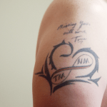 5 metod odstranění tetování: Zkušenosti s nimi a zhodnocení jejich bezpečnosti